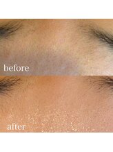 ソワイユ 浜松店(Soyeux)/ワックス脱毛（wax xxx ）