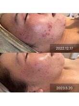 ビューティリュクス(beauty luxe)/最短で理想に近づける！