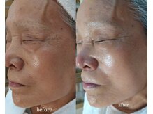 コールドゥ(Coeur-Doux)/何歳になっても綺麗になれる！