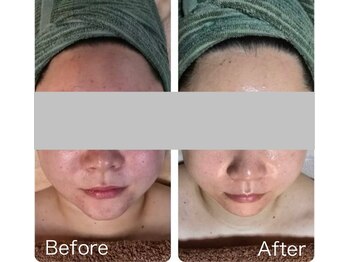 ミイン(MIIN)/ララピール&水玉リフティング