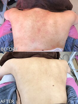 ビアンカ/お客様のお声