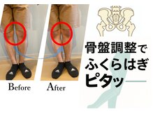 整骨院リライフ 熊本市北区本店(整骨院Re.life)の雰囲気（待合席）