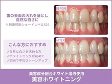 ホワイトニングが初めての方にオススメ