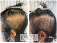 サラシック(salachic)