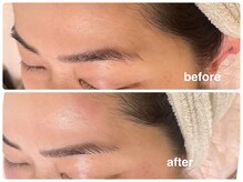 アップル マリー 江別/■糸脱毛（似合わせ眉毛脱毛）