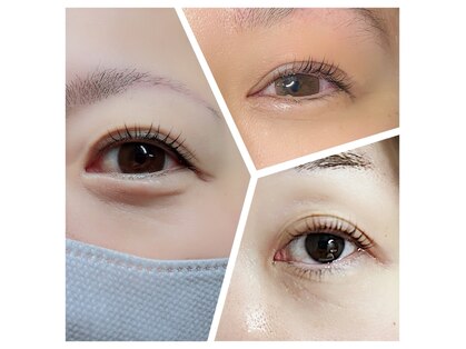 スリール(sourire)の写真