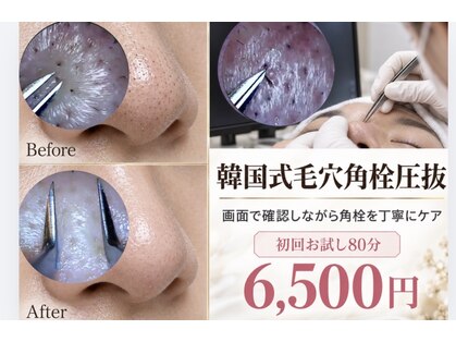 モミン(MOMI.N)の写真