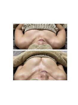 ルアナスタイル(Luana style)/