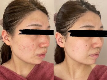 アルメリア(Armeria)/【結果写真】