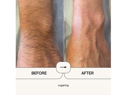 メンズ ザ シュガーリング(MEN'S The Sugaring)の写真