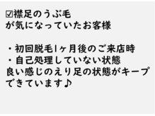 ニコ アンド キャンディー(Nico.&Candy)/脱毛は卒業出来る美容☆ 