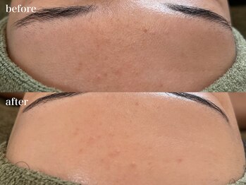 リボーン 浜松(reborn)/