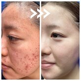 グリッター(GLITTER)