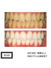 レオン 磐田(REON)/◇ お客様 before＆after ◇