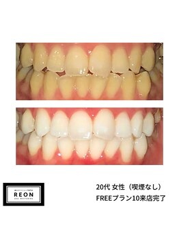 レオン 磐田(REON)/◇ お客様 before＆after ◇
