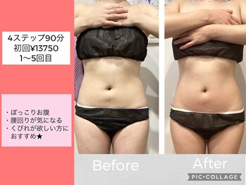 ハピネス(HAPPINESS)/お腹　4ステップ90分　1～5回目