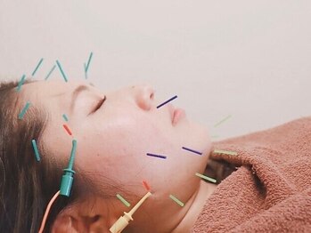 おはな整骨院 帯山院の写真/自分史上最高の小顔へ!老廃物の排出を促進しむくみ解消にも◎【OHANA美容鍼☆小顔コース¥4,400~】