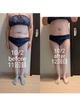 リルーチェ 倉敷(Riluce)/ぽっこりお腹撃退！