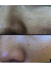 シャラ(shara)/老け顔、疲れた肌に特化