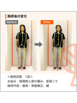 ただき接骨院 整体院 高崎本院/お悩み：股関節・膝の痛み