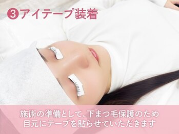 リラ 藤が丘店(Lila)/3.アイテープ装着