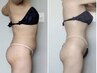 【40代人気!】座ると乗っかるお腹の肉‥今すぐ上半身痩せ!痩身 通常¥22000