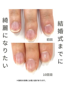 最強ネイルケア
