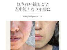 ミミルーチェ(mimiluce)/ほうれい線たるみケア得意です