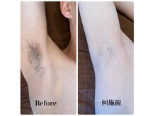 ベリンダ(BELINDA)の雰囲気（脱毛講師在籍の圧倒的効果★都度払い制）