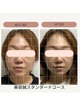 サロン ド ハリッシュ(Salon de HARISH)/左右バランスを整えます◎