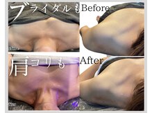 サロン エス(salon S)の雰囲気（肩・首コリを手技で改善させなかった方へ！）