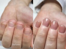 ミンスネイル(Mins Nail)/深爪3回コース