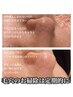 【顔面毛穴洗浄】ラジオ波と超音波で皮脂汚れごっそり！毛穴洗浄￥4,400　