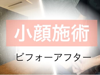 ゲントツ 新宿/小顔　小顔矯正