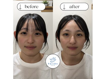 ハリボケア 葛西(haribo care)の写真