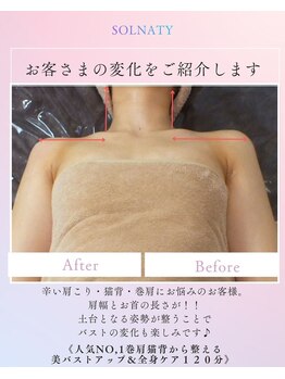 ソルナティ 伊勢原(SOLNATY)/巻肩・肩幅・首肩の変化をご紹介