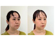 スタイルキューピット(style cupit)/メイクビフォアフター＊30代