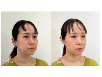 スタイルキューピット(style cupit)/メイクビフォアフター＊30代