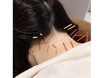 あたまの再起動/慢性的な【首肩凝り】に