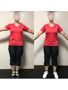 インペリアルボディ(Imperial Body)/Before After 30代女性 N様