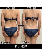 エール(AeLL)/☆ラジオスティム☆