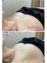 ルプリュシュ ルフレ(Le plus reflet)/クイックバストアップ