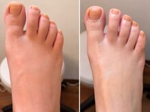 フス(FUSS)/foot&bodycare FUSS