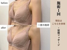 ソワ(soie)/太れない方も大丈夫、諦めないで