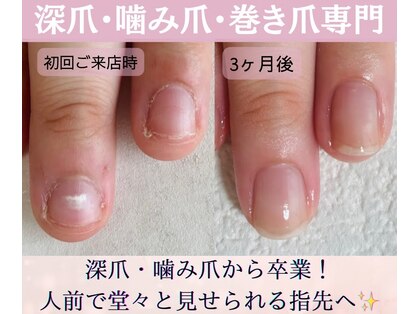 シーネイル(C Nail)の写真