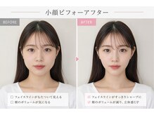 ベアフット(BARE FOOT)/痩せる前に整える