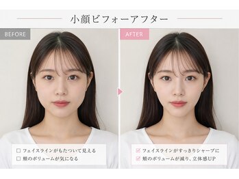 ベアフット(BARE FOOT)/痩せる前に整える
