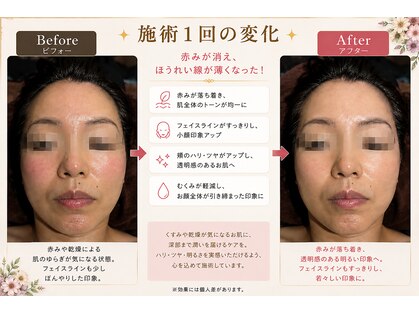 レヴォーテ 練馬(Re-Beaute)の写真