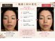 レヴォーテ 練馬(Re-Beaute)の写真