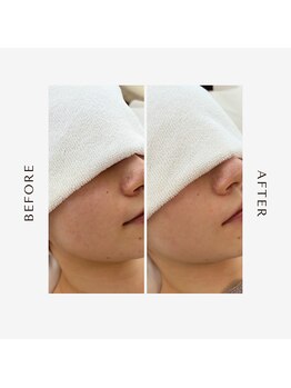 オーシャン(OCEAN)/before after